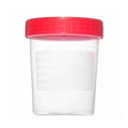 Vaso muestra orina